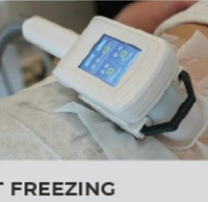 Fat Freeze  - One area (1 x Fat freeze + 4 x shockwaves)